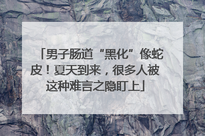 男子肠道“黑化”像蛇皮！夏天到来，很多人被这种难言之隐盯上
